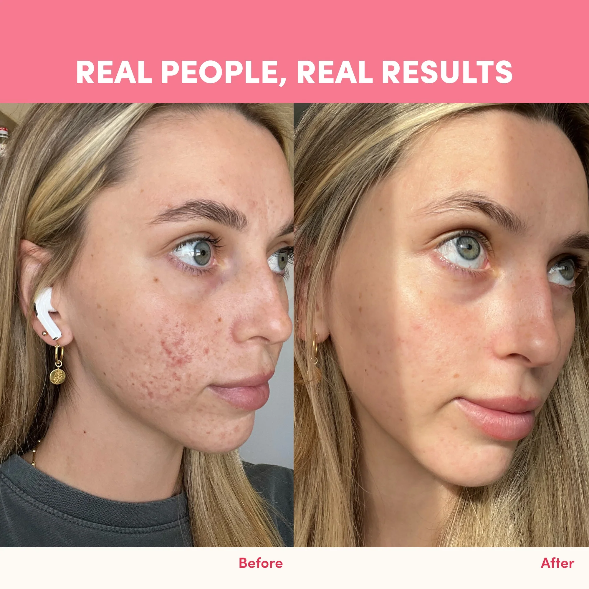 Gut Feelings Beauty Bundle - Image 9